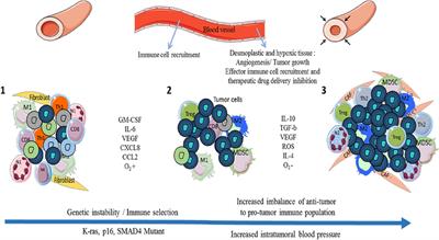 Pancreatic Ductal Adenocarcinoma: A Strong Imbalance of Good and Bad Immunological Cops in the Tumor Microenvironment